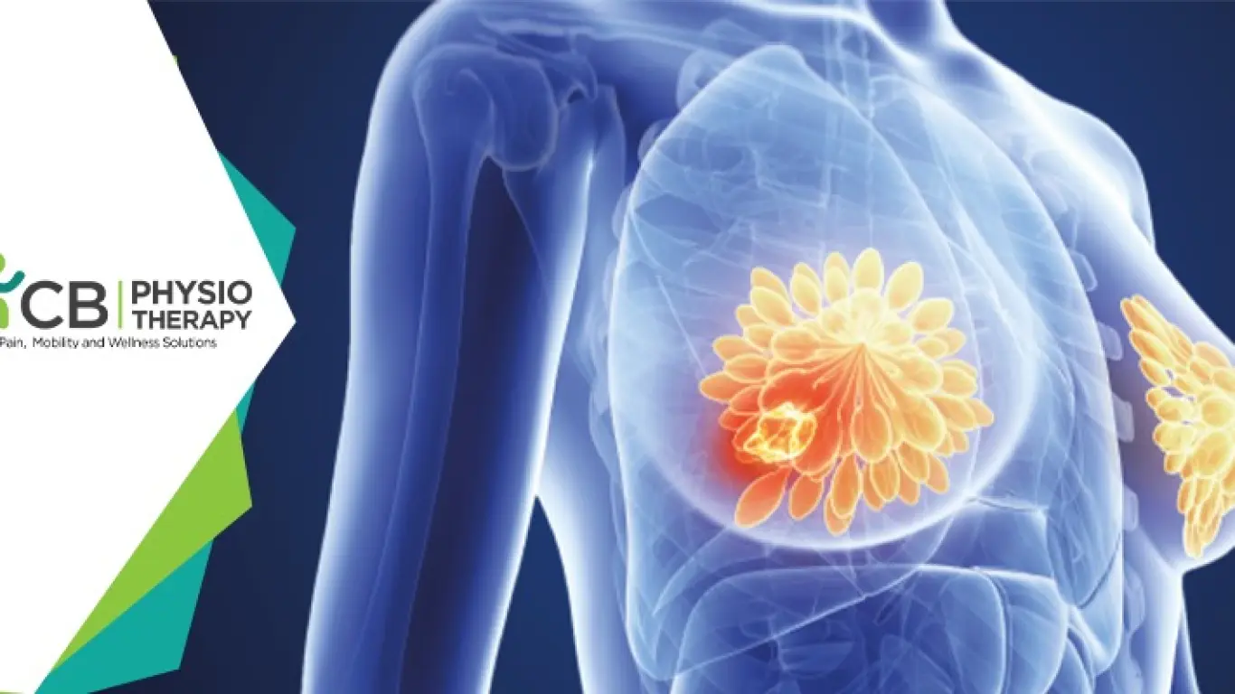 10 Best Exercises For Breast Cancer Patients