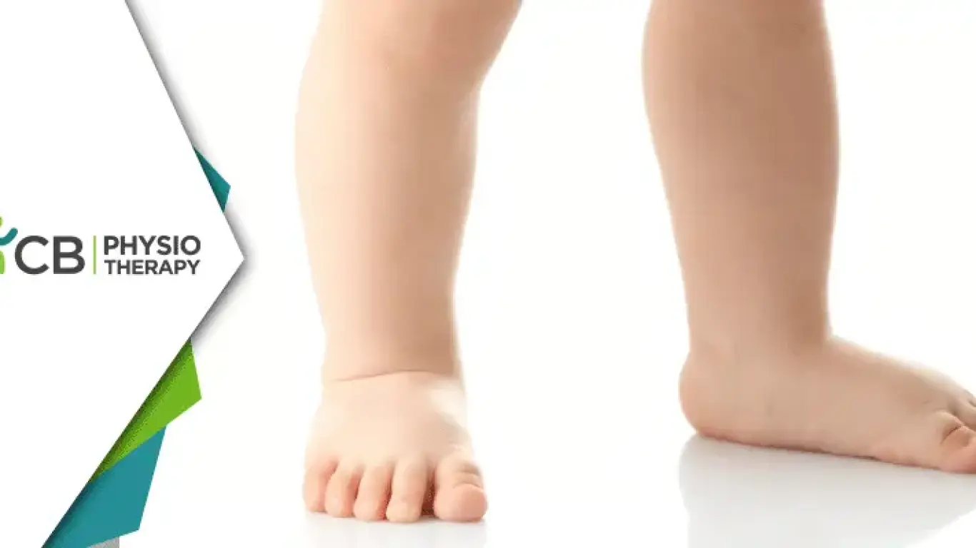 Flat Feet In Kids | How Physiotherapy Can Help In Managing The Condition?