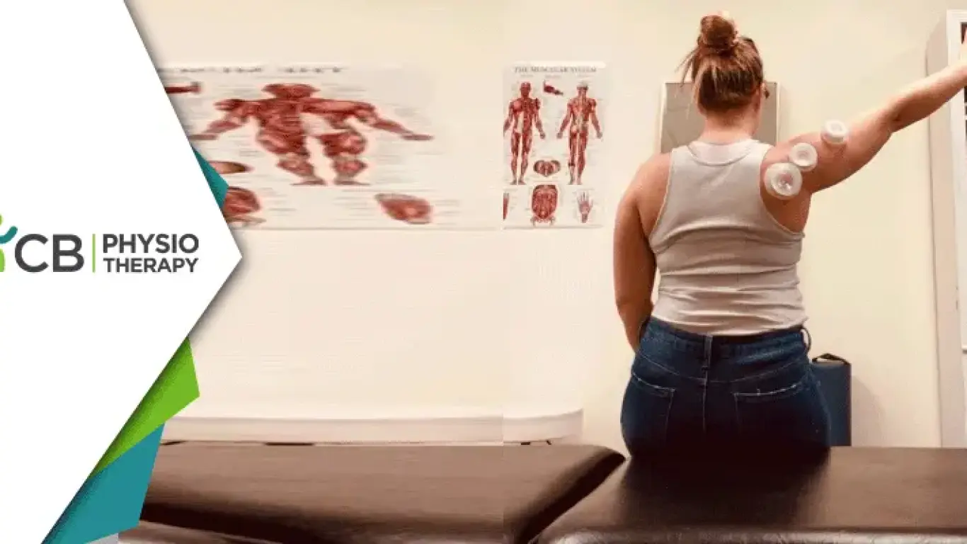 Functional Cupping In Physiotherapy | Enhancing Mobility And Promoting Effective Recovery
