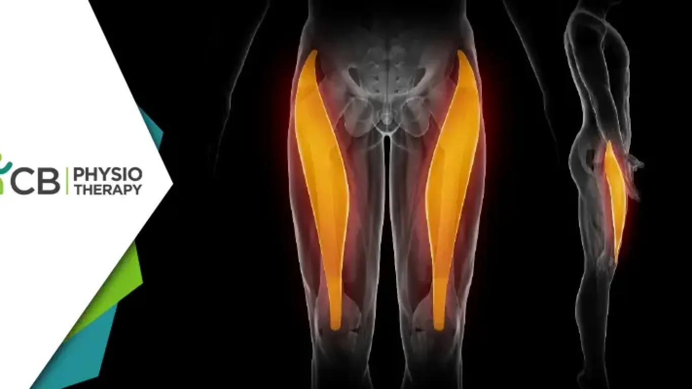 Managing Quadriceps Strains In Sports | How Physiotherapy Facilitates The Road To Recovery?