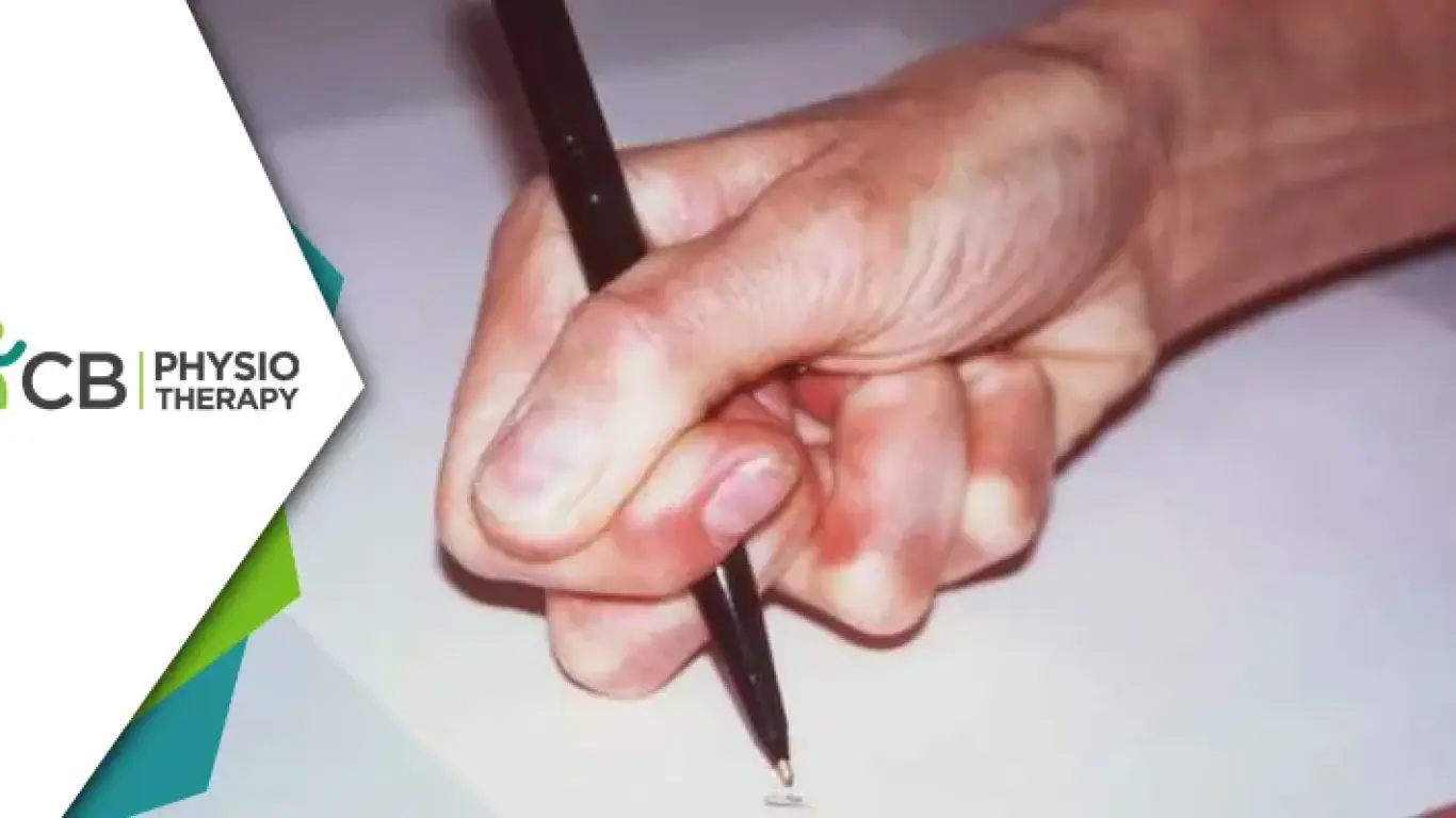 Managing Writer's Hand | The Crucial Role Of Physiotherapy In Alleviating Symptoms