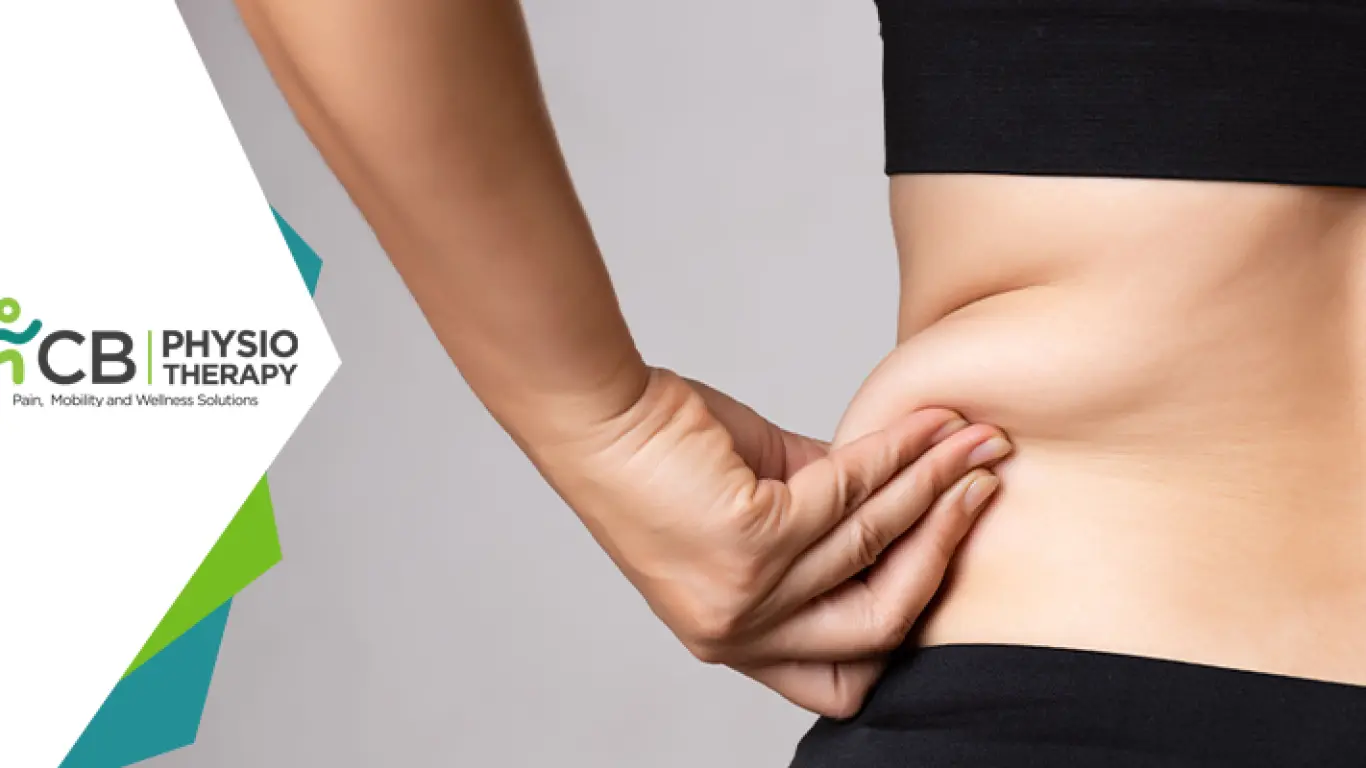 Physiotherapy After Liposuction | A Way To Maintain Your Body Contour