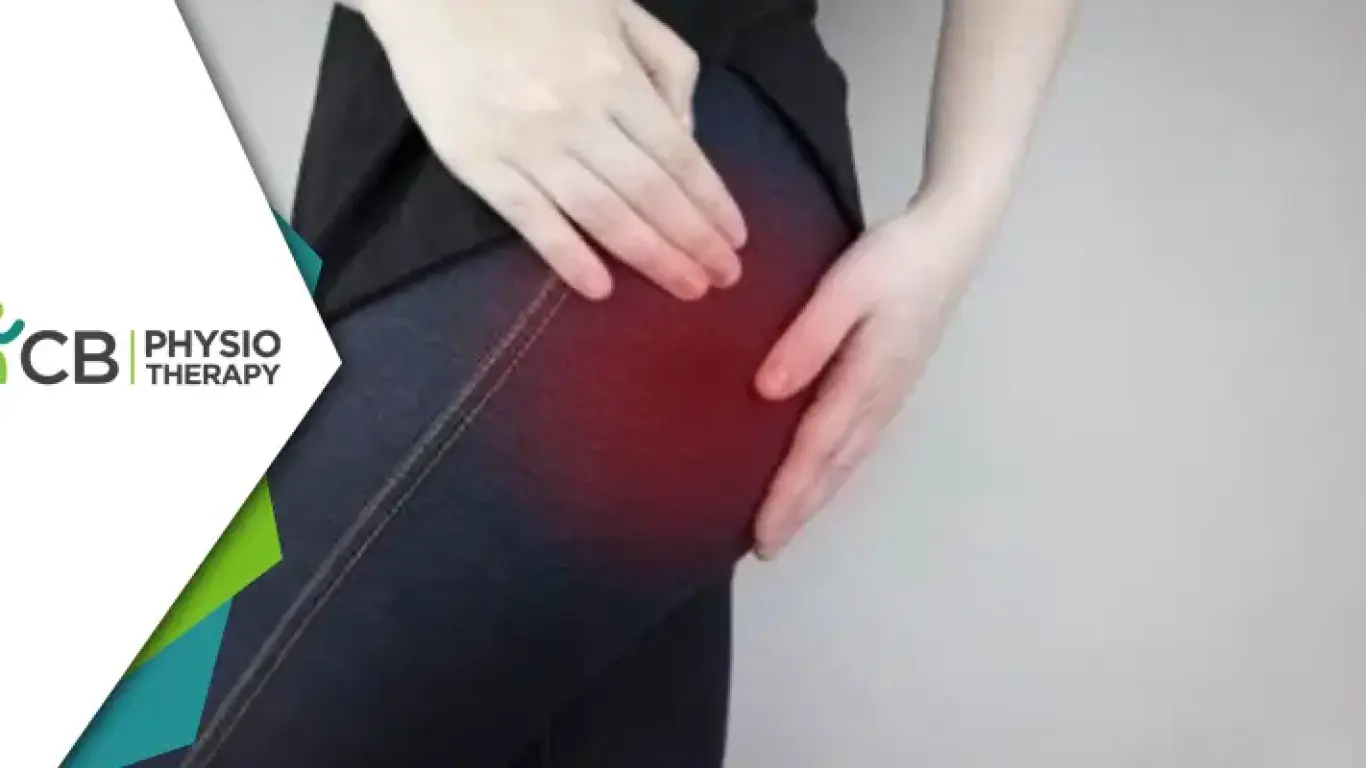 Piriformis Syndrome Relief | Unveiling The Vital Role Of Physiotherapy In Pain Management