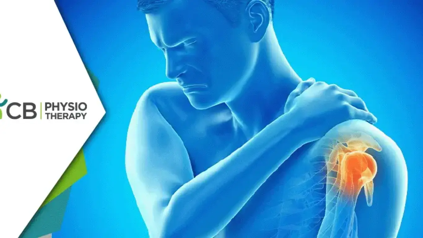 Recovering From Shoulder Dislocation | The Essential Role Of Physiotherapy In Restoring Mobility And Strength