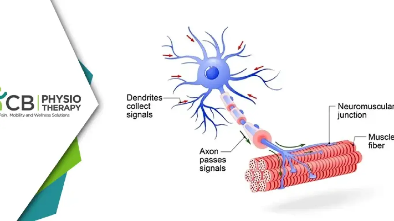 Understanding Motor Neuron Lesions And Associated Diseases