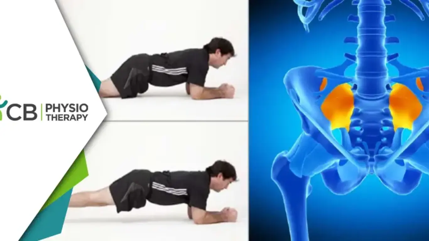 Unlocking The Path To Comfort | Managing Sacroiliac Joint Pain With Physiotherapy