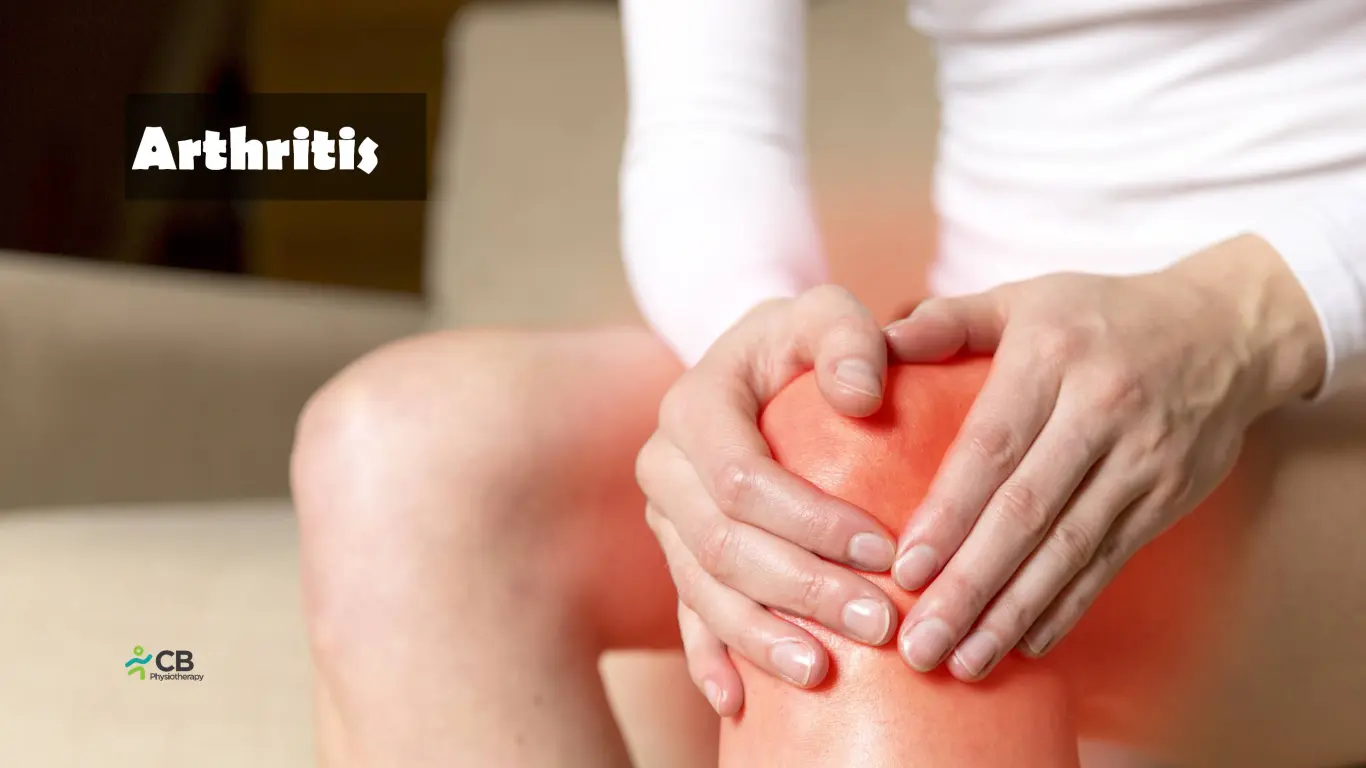 World Arthritis Day: Managing Arthritis – Causes, Prevention & Treatment.