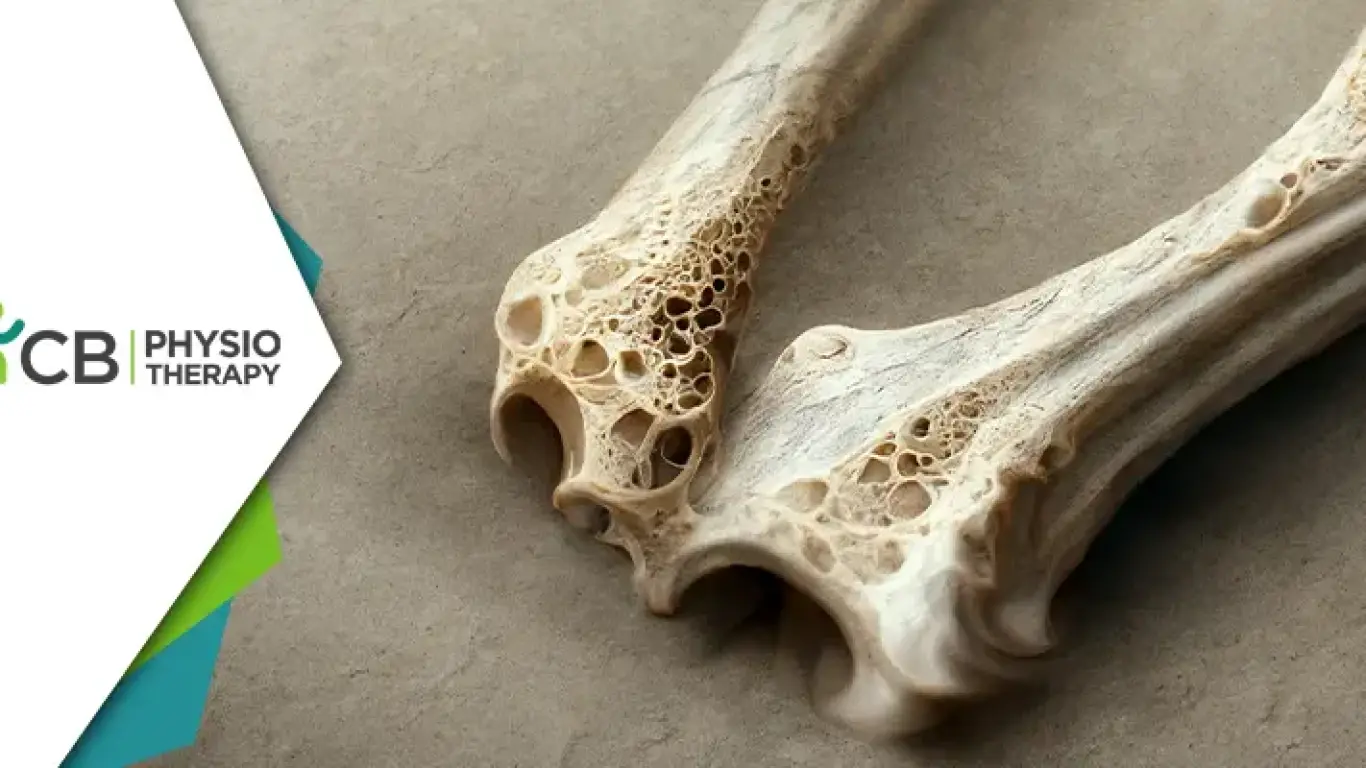 World Osteoporosis Day 2023 | Unveiling The Vital Role Of Physiotherapy In Strengthening And Managing Bone Health
