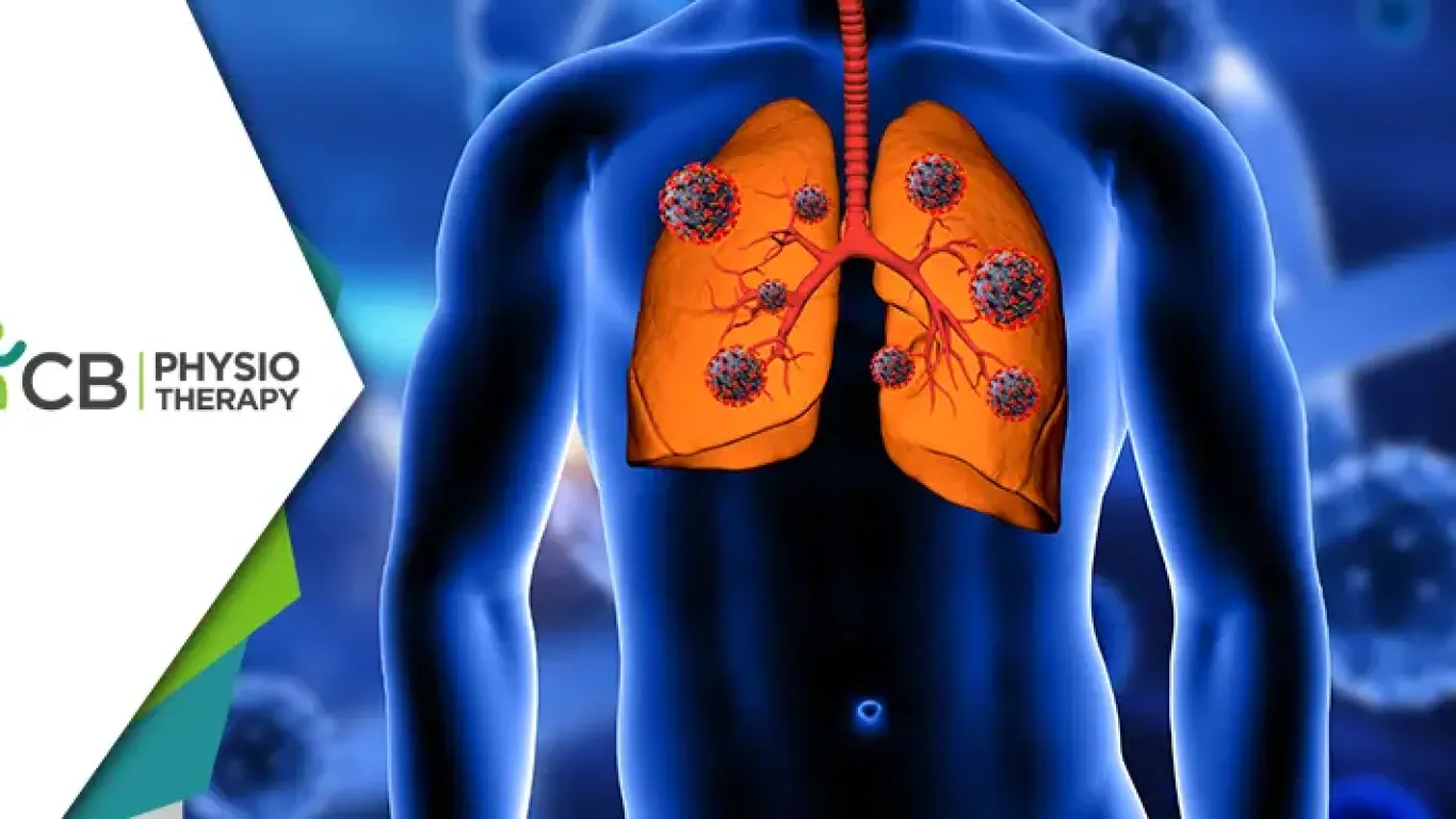 World Pneumonia Day | Highlighting Physiotherapy's Essential Role In The Global Fight Against Pneumonia