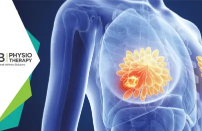 10 Best Exercises For Breast Cancer Patients