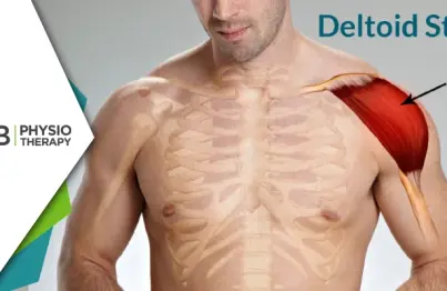 Deltoid Strain | Understanding Causes, Symptoms, And The Role Of Physiotherapy In Recovery