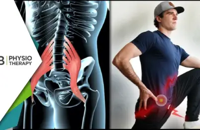 Enhancing Flexibility | Understanding Muscle Tightness And The Role Of Physiotherapy