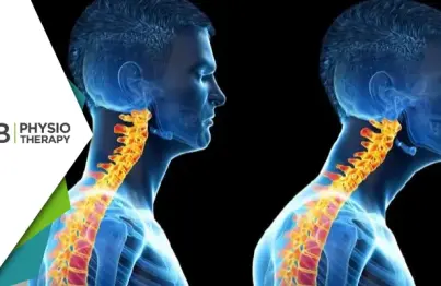 Forward Head Posture | Understanding Its Impact On Neck And Shoulder Pain And How Physiotherapy Can Provide Relief?