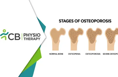 From Bone Loss To Bone Strength | Physiotherapy For Osteopenia, Osteoporosis & Arthrosis
