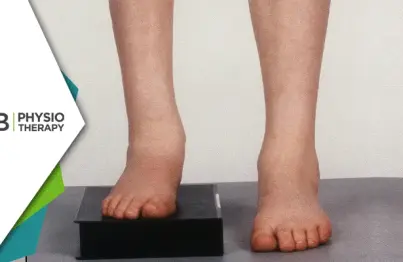 Limb Length Discrepancy | Understanding Its Impact And The Role Of Physiotherapy In Management
