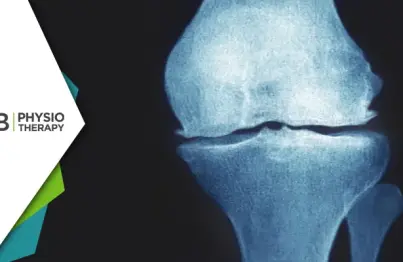 Managing Knee Pain | Understanding Osteophytic Changes And The Role Of Physiotherapy