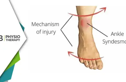 Preventing And Managing High Ankle Sprains | Essential Physiotherapy Tips And Strategies
