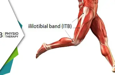 Recovering Agility | Overcoming Iliotibial Tract Syndrome Through Effective Physiotherapy