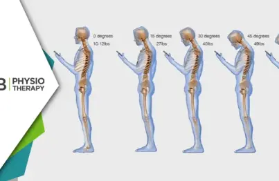Text Neck Syndrome | How Physiotherapy Can Prevent And Treat This Modern-day Epidemic
