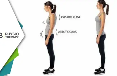 The Impact Of Poor Posture On Musculoskeletal Health | How To Prevent, Manage, And Benefit From Physiotherapy?