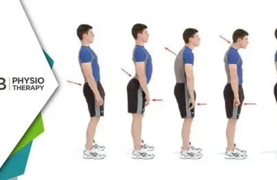 Why Posture Matters | How Physiotherapy Posture Assessment And Correction Can Prevent Chronic Pain And Boost Overall Health
