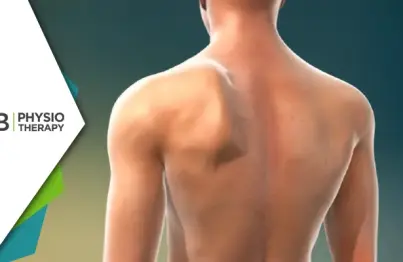 Winged Scapula | The Vital Role Of Physiotherapy In Effective Management