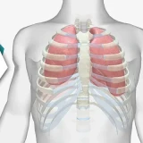Reviving Comfort | The Crucial Role Of Physiotherapy In Costochondritis Recovery