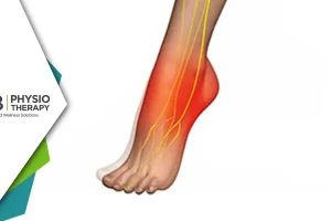 Managing Foot Drop In Spondylolisthesis | Effective Physiotherapy Techniques For Improved Mobility And Quality Of Life