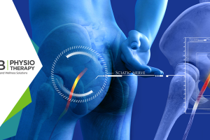 Sciatica | How Physiotherapy Management Helps In Relieving The Sciatic Nerve Pain?
