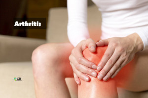 World Arthritis Day: Managing Arthritis – Causes, Prevention & Treatment.