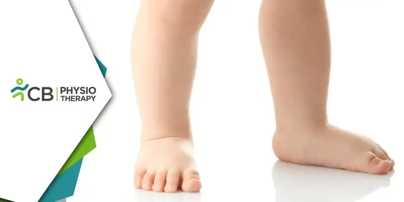 Flat Feet In Kids | How Physiotherapy Can Help In Managing The Condition?