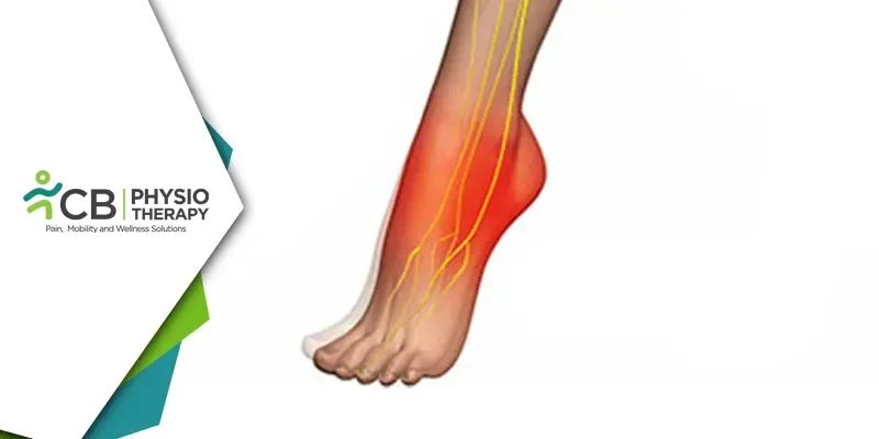 https://cbphysiotherapy.in/storage/images/blog_image/800_400/managing-foot-drop-in-spondylolisthesis-effective-physiotherapy-techniques-for-improved-mobility-and-quality-of-life.webp