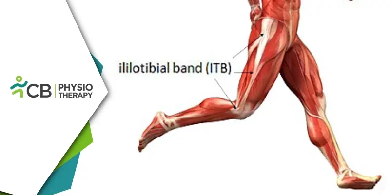 Recovering Agility, Overcoming Iliotibial Tract Syndrome through Effective  Physiotherapy