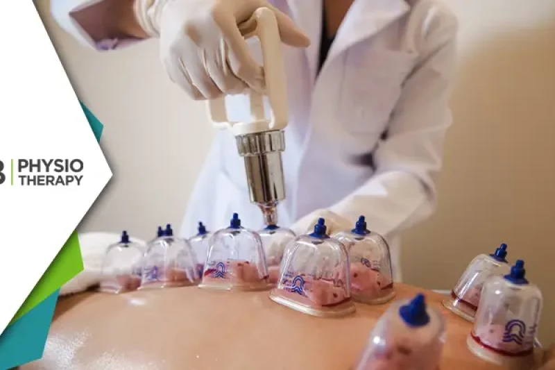 Cupping Therapy(hijama) | Unlocking Health Benefits In Physiotherapy