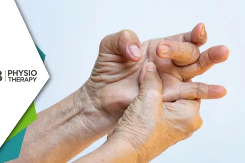 Easing The Grip | The Role Of Physiotherapy In Treating Trigger Finger