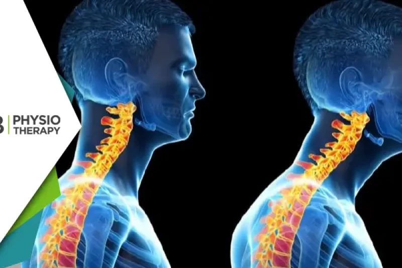 Forward Head Posture | Understanding Its Impact On Neck And Shoulder Pain And How Physiotherapy Can Provide Relief?