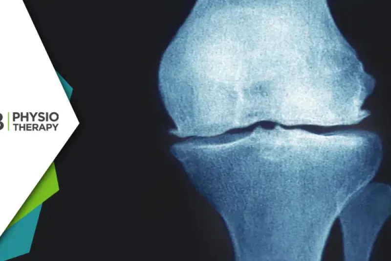 Managing Knee Pain | Understanding Osteophytic Changes And The Role Of Physiotherapy