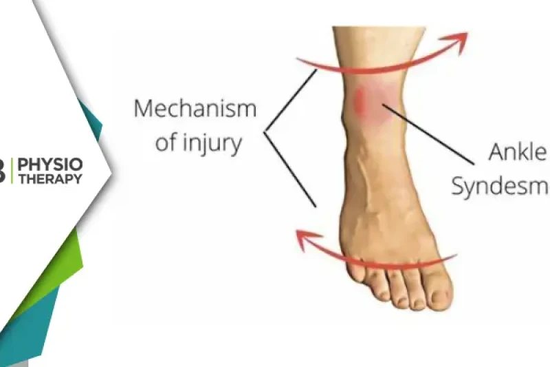 Preventing And Managing High Ankle Sprains | Essential Physiotherapy Tips And Strategies