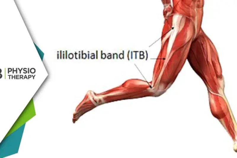 Recovering Agility | Overcoming Iliotibial Tract Syndrome Through Effective Physiotherapy