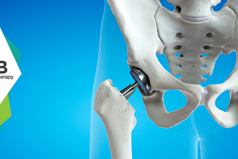 What Not To Do After Hip Replacement Surgery?