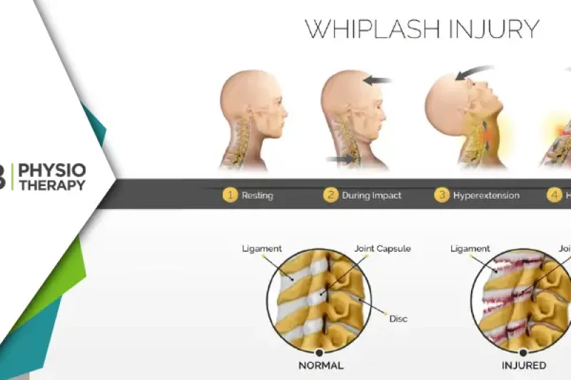 Whiplash Injury | How Physiotherapy Aids In Effective Treatment And Recovery