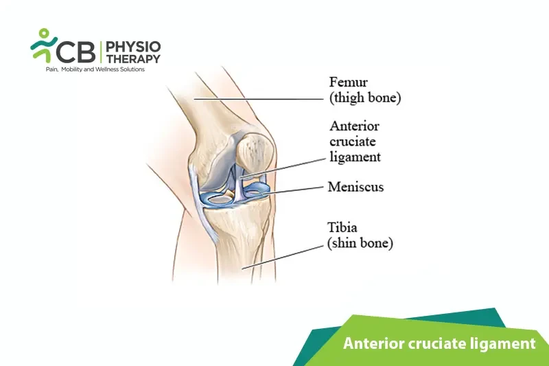 anterior-cruciate-ligament-tear-acl.webp
