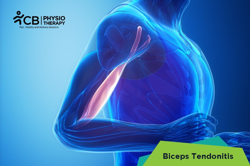 biceps-tendonitis.webp