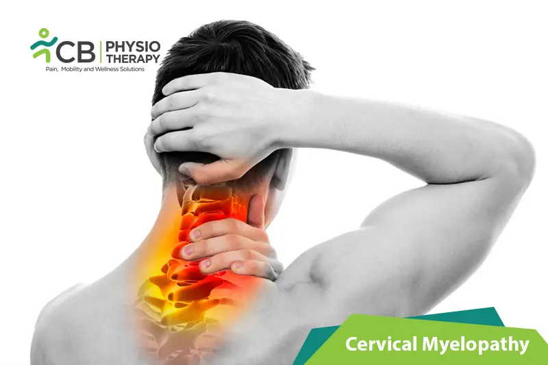 Cervical Myelopathy