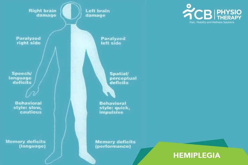 Hemiplegia