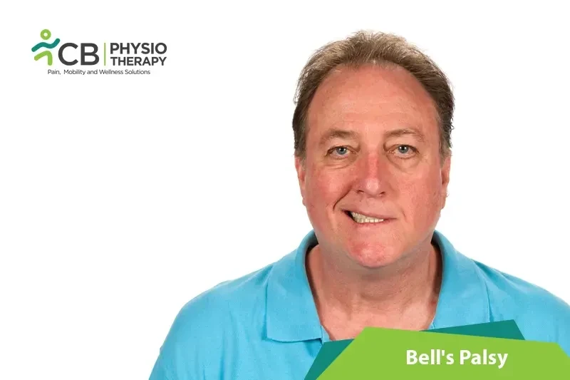 Top 5 Exercises For Bell's Palsy Or Facial Palsy