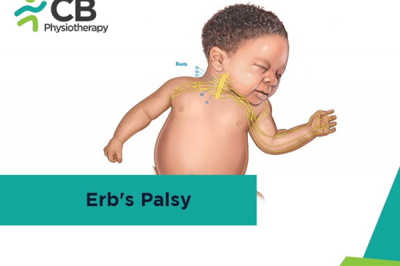Top 5 Exercises For Erb’s Palsy