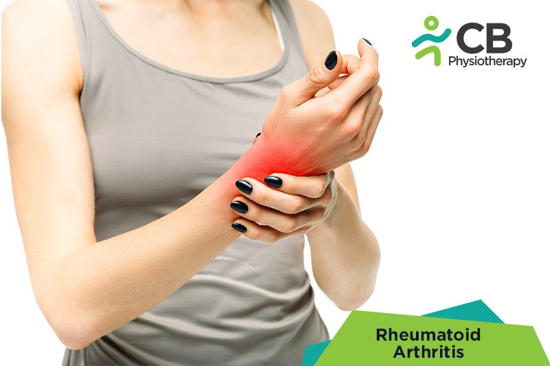 Top 5 Exercises For Rheumatoid Arthritis
