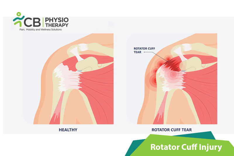 Top 5 Exercises For Rotator Cuff Injury