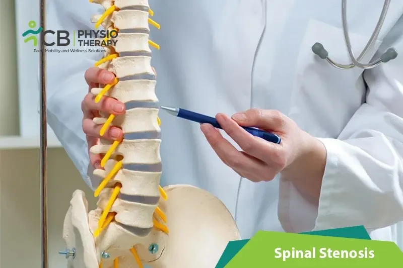 Top 5 Exercises For Spinal Stenosis